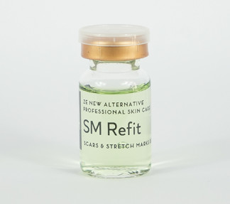 SM REFIT