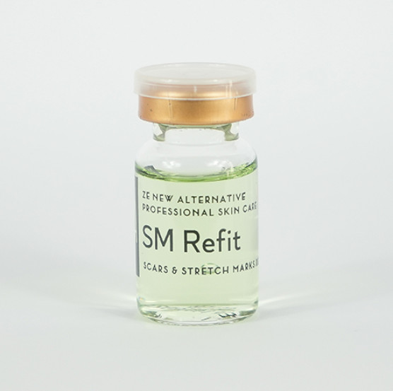 SM REFIT
